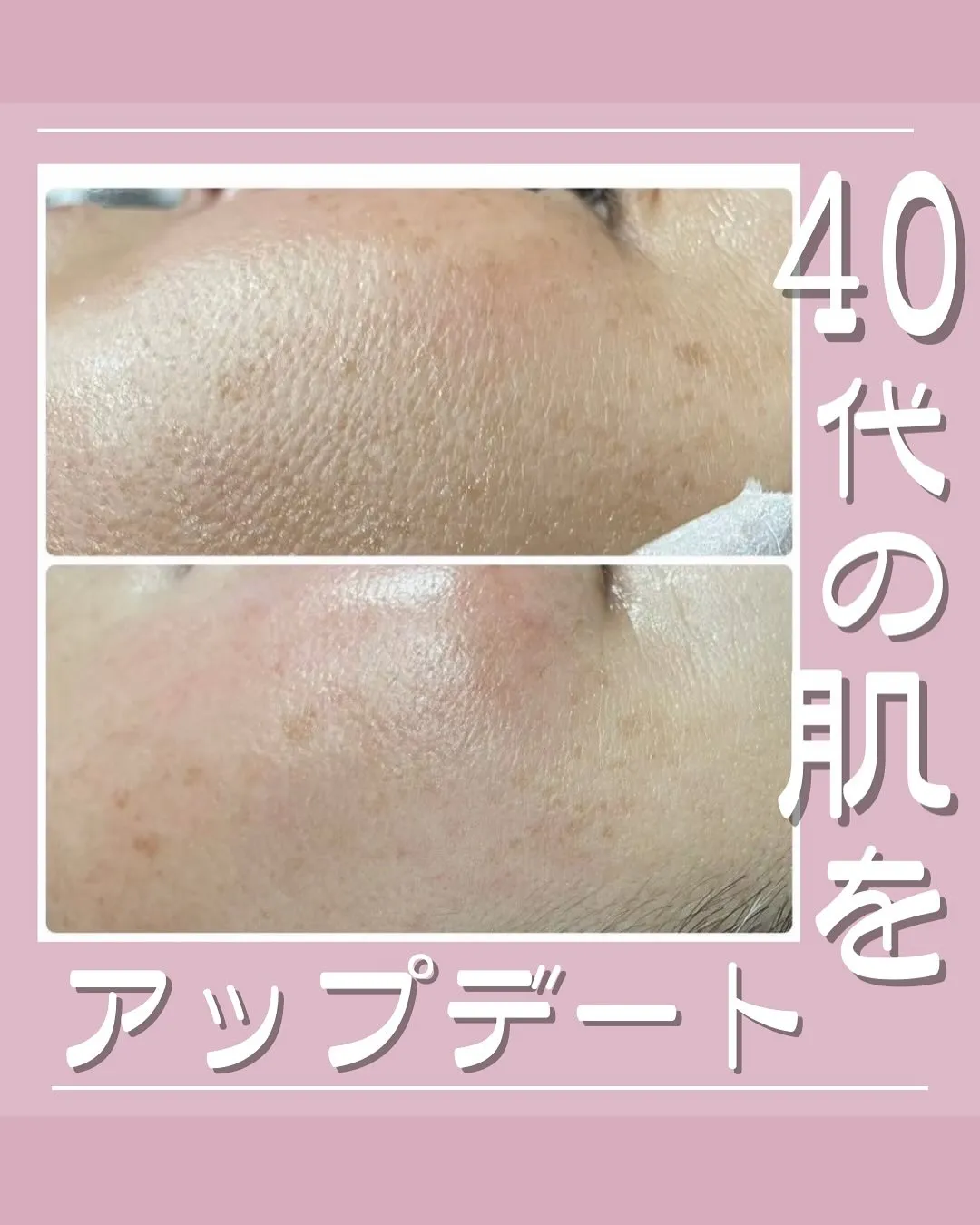 40代の肌をアップデート