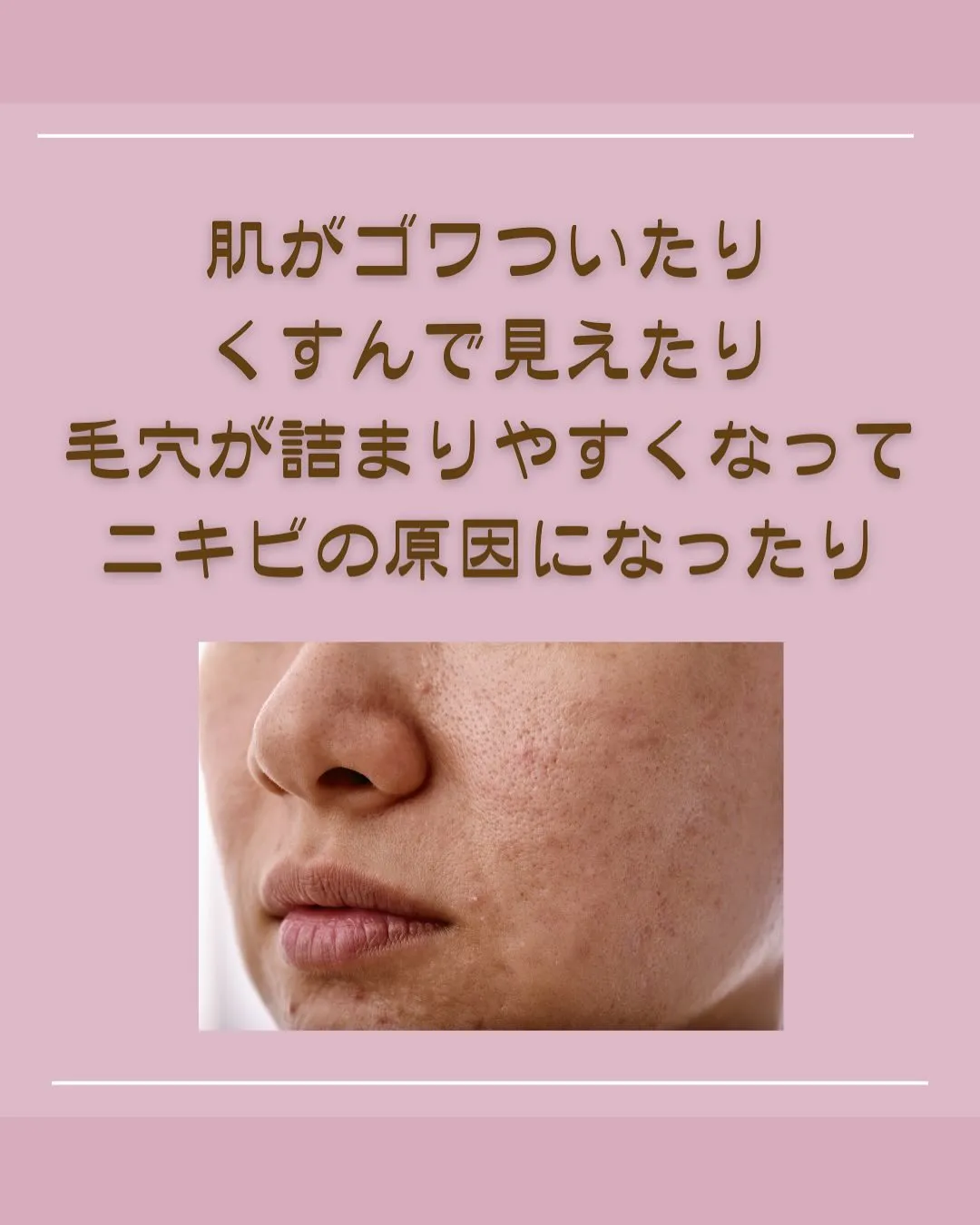 40代の肌をアップデート