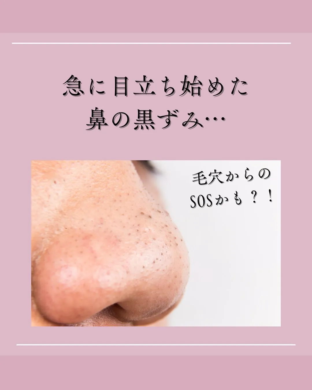 お疲れ毛穴から卒業！