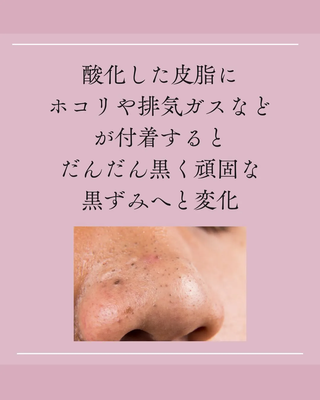 お疲れ毛穴から卒業！