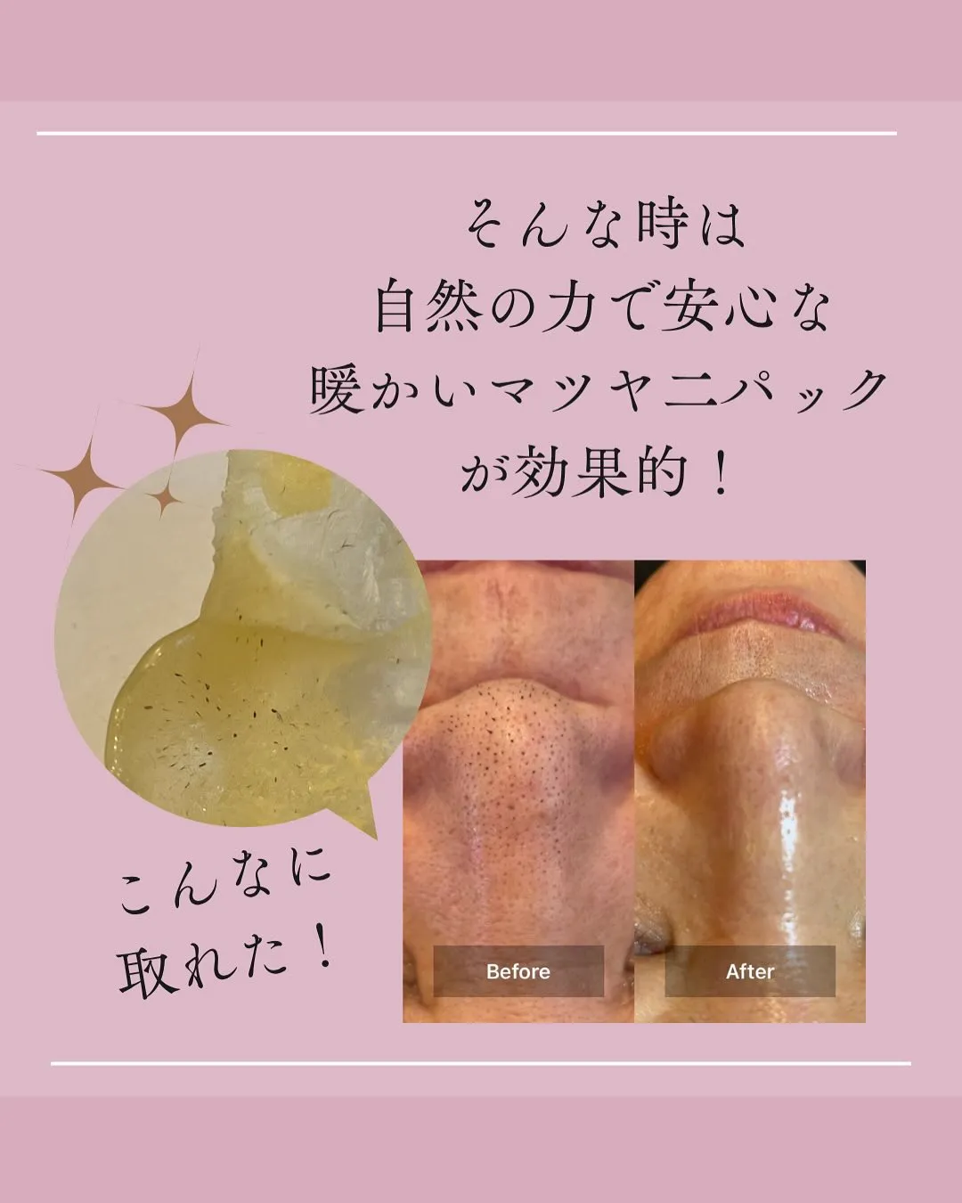 お疲れ毛穴から卒業！