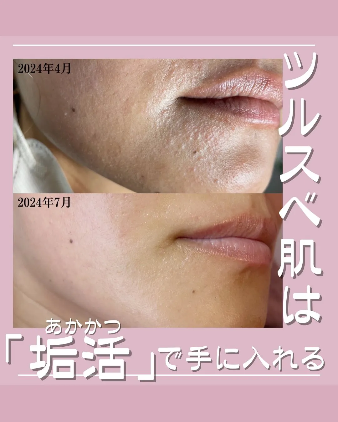 <鎌倉>垢と美肌