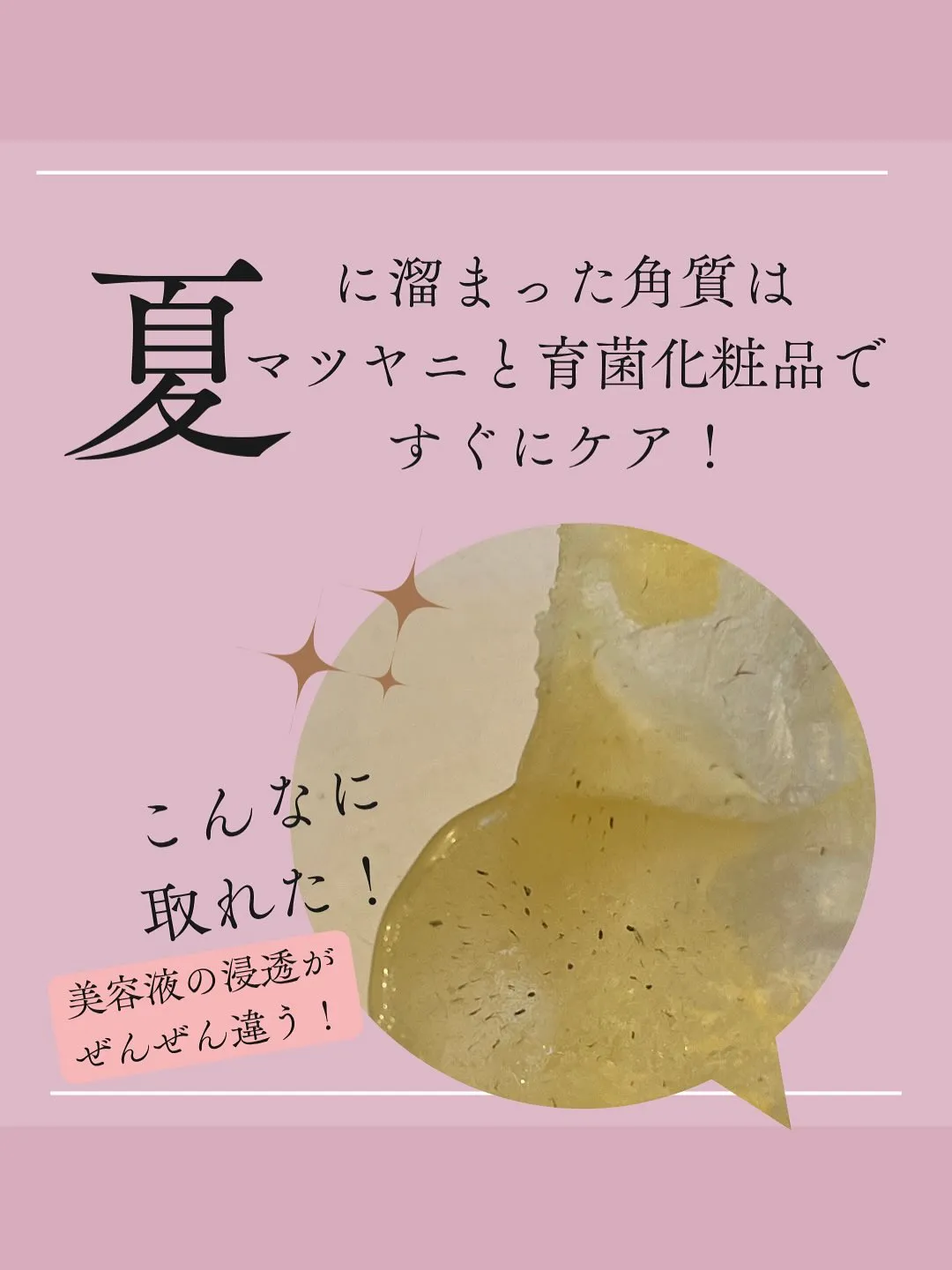 夏に差がつく！角質ケア！