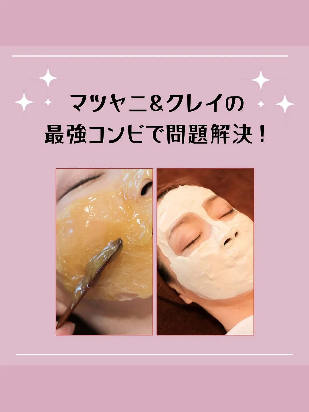 夏の間に増えた皮脂や汗が毛穴を詰まらせてしまうことも...