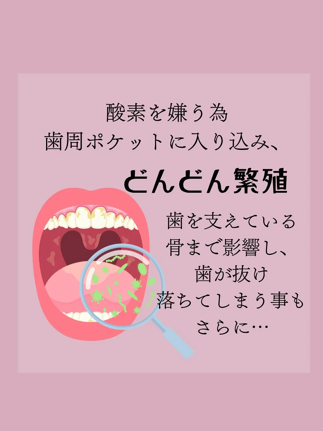 歯周病が引き起こす意外な全身トラブルとは？