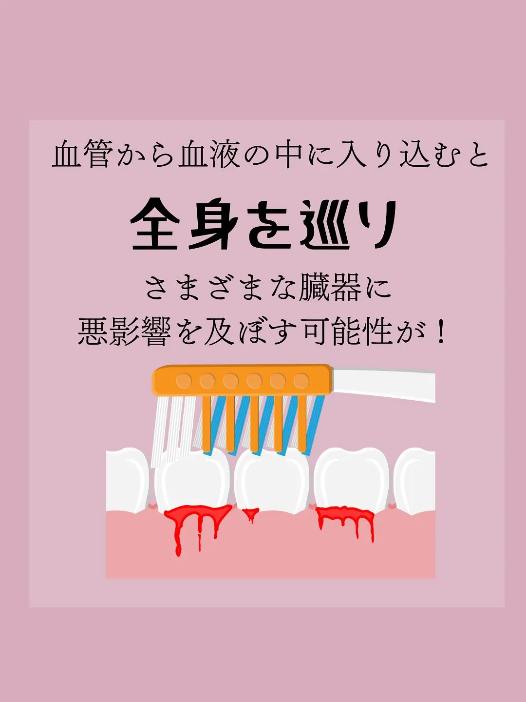 歯周病が引き起こす意外な全身トラブルとは？