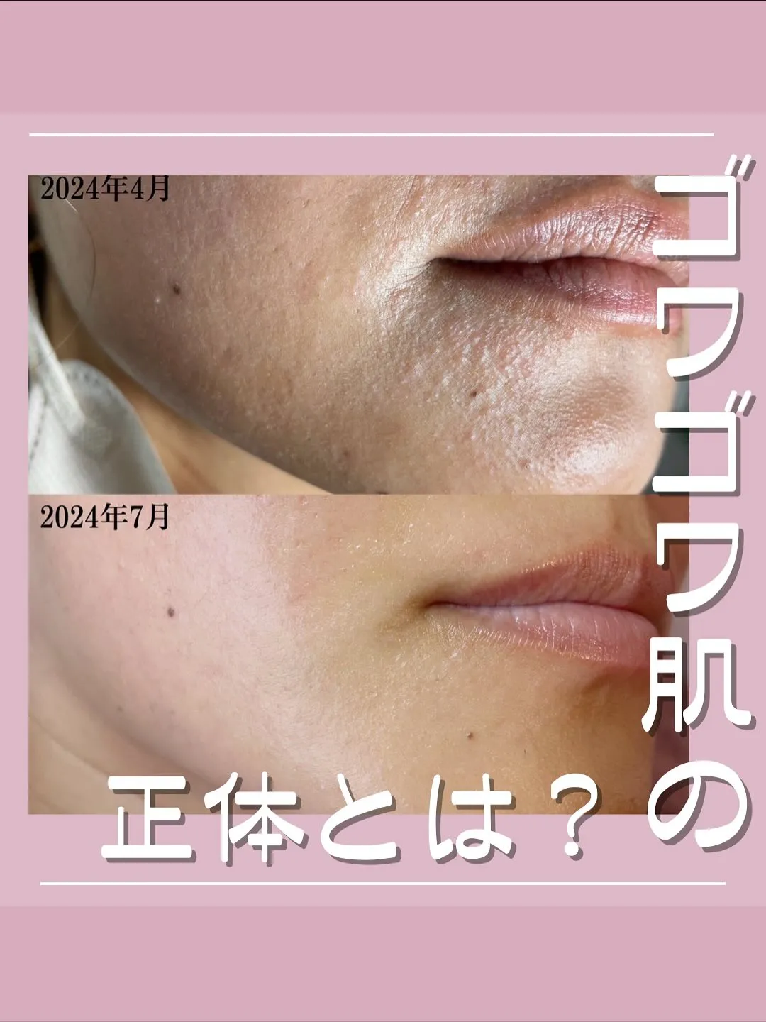 夏のお疲れ肌をリセットして、秋の美しい肌を迎え入れましょう！