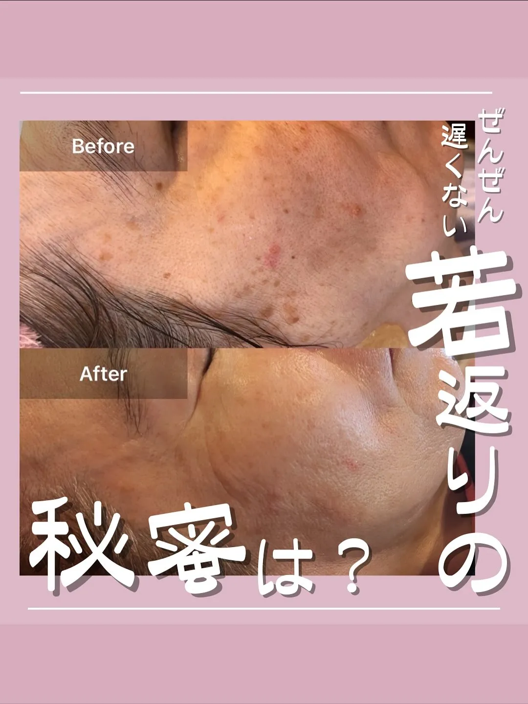 「若い頃の肌に戻りたい…」