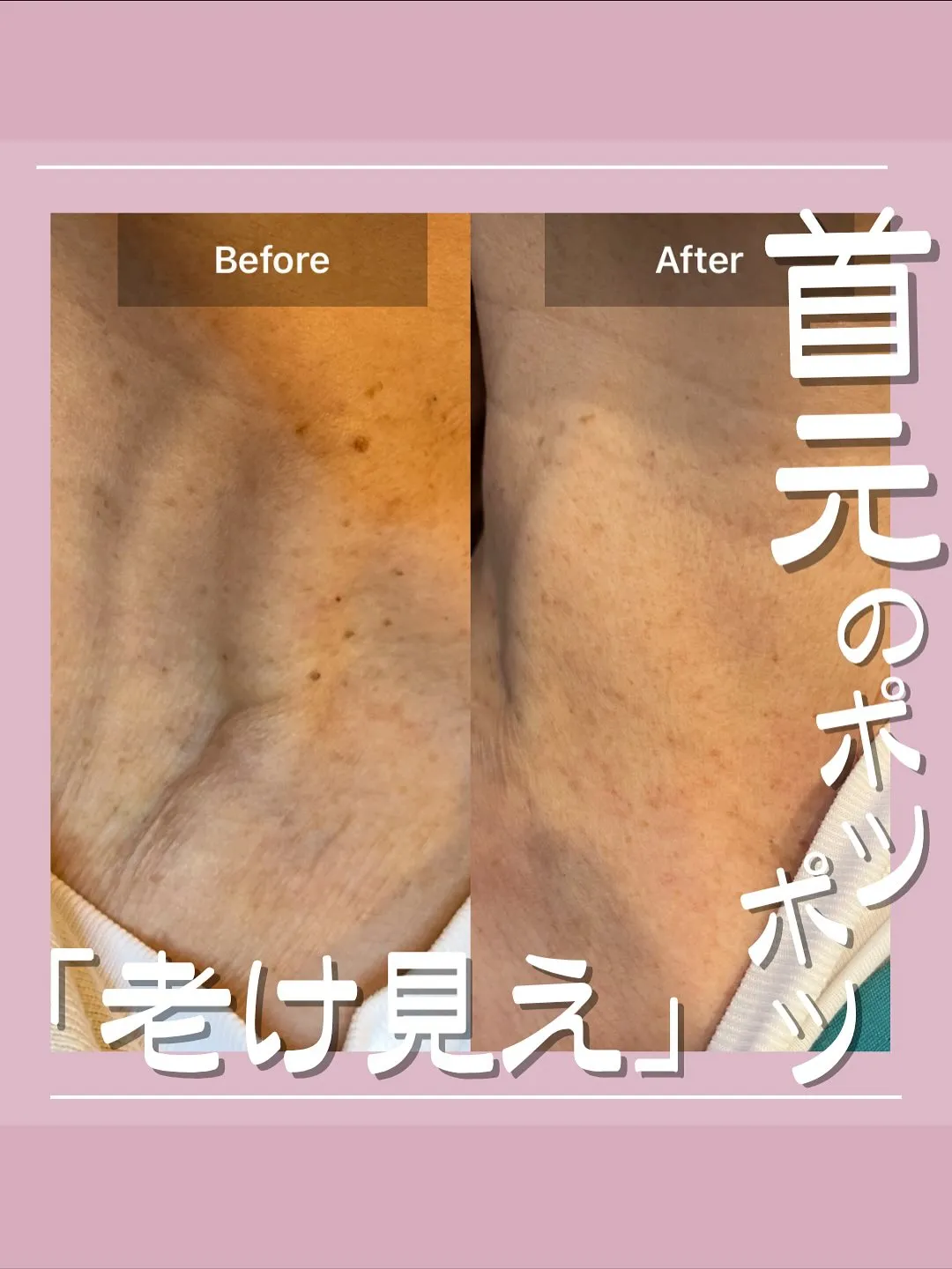 <鎌倉>見られてますよ！貴方の首もと年齢