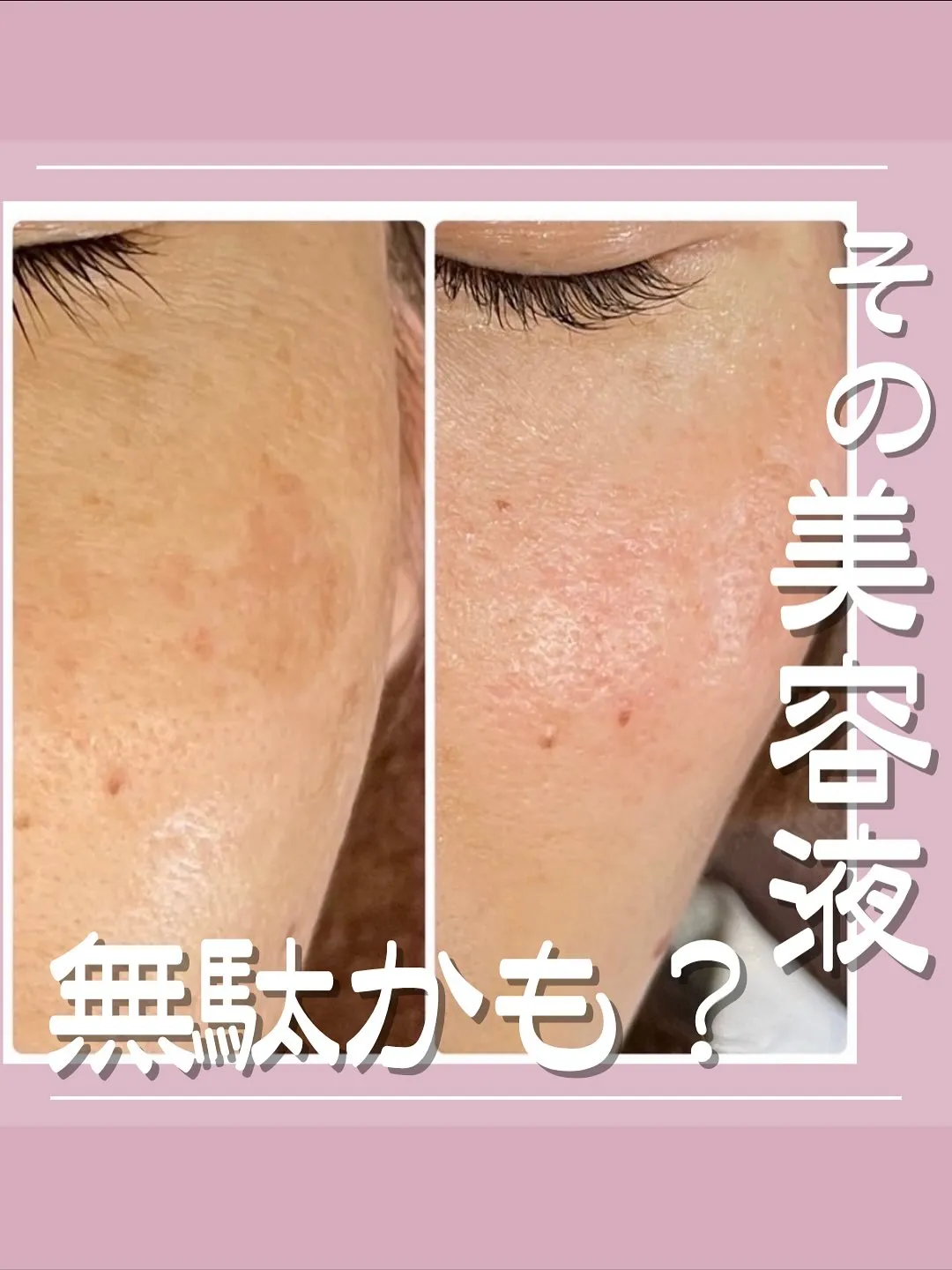 頑張っても昔のようにハリやツヤが戻らないのは、