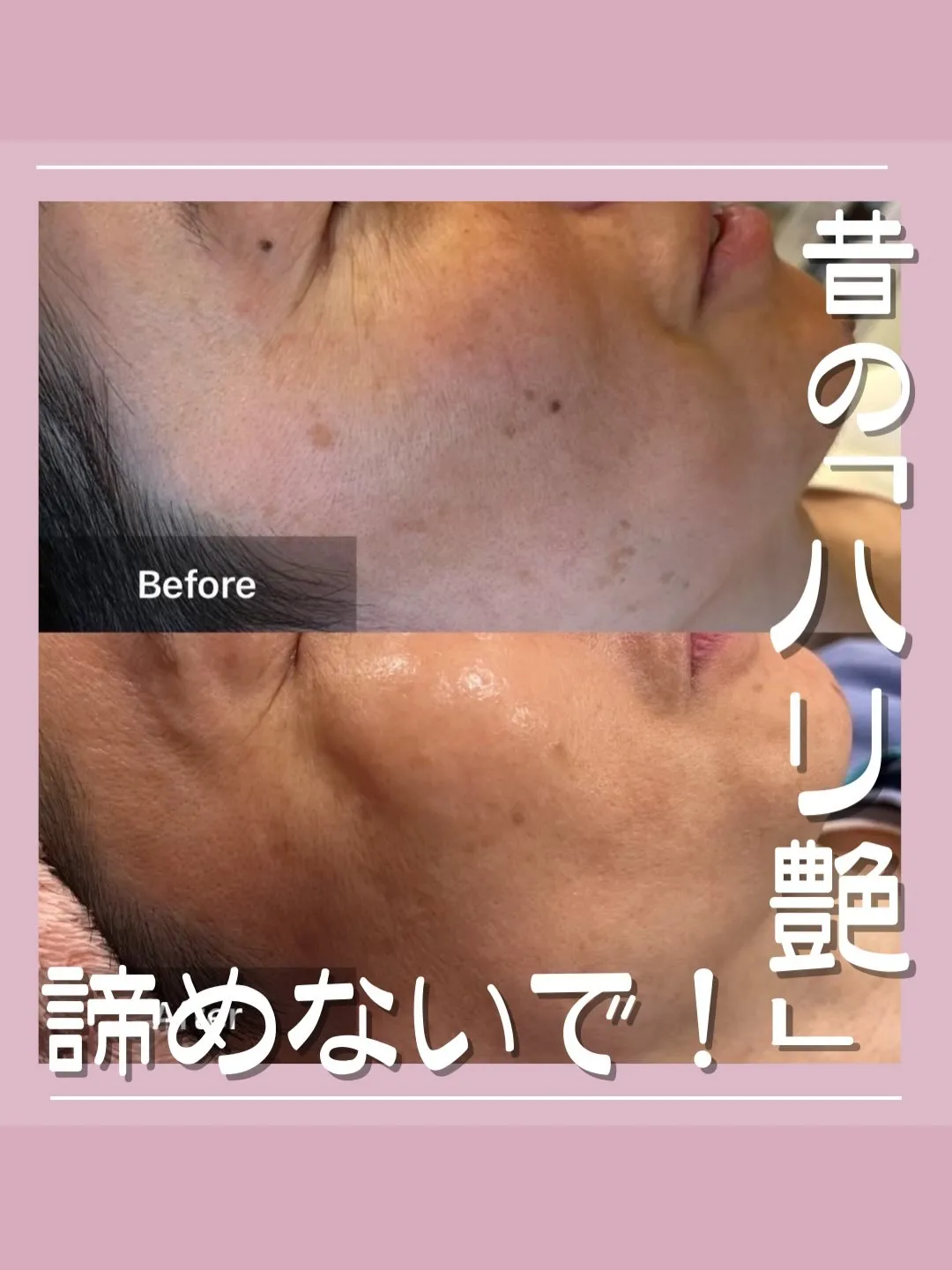 <鎌倉>昔の「ハリ艶」諦めないで！