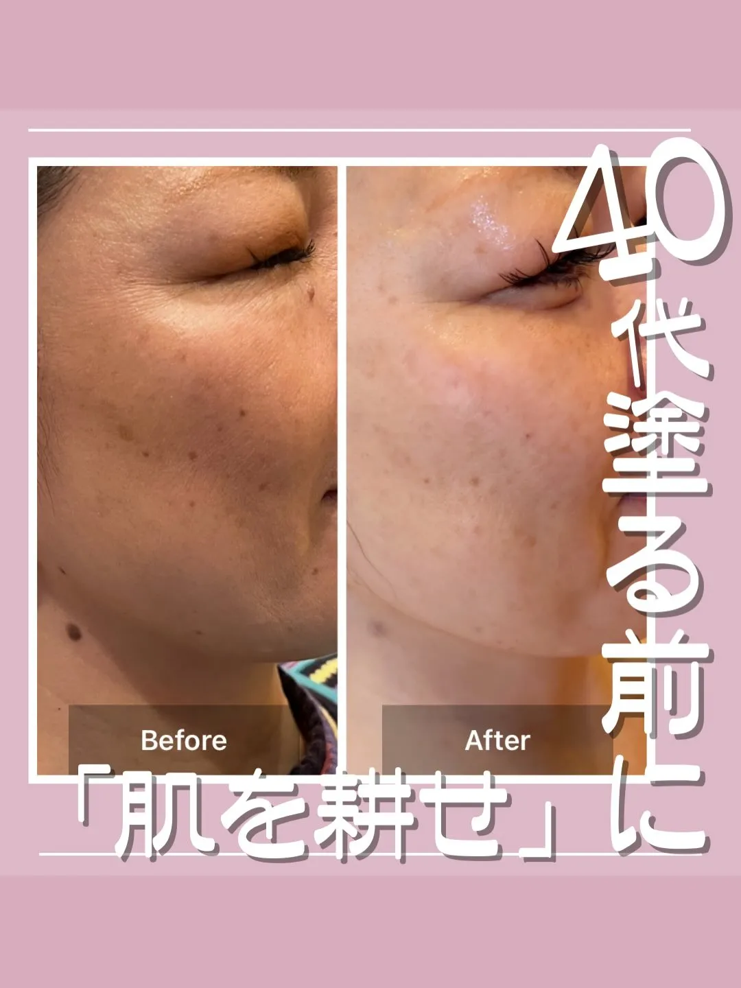 <鎌倉>40代の肌、「塗る前に耕せ！」