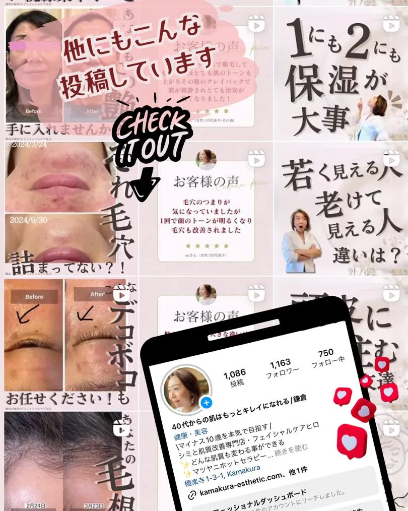 お客様の声→マツヤニパック