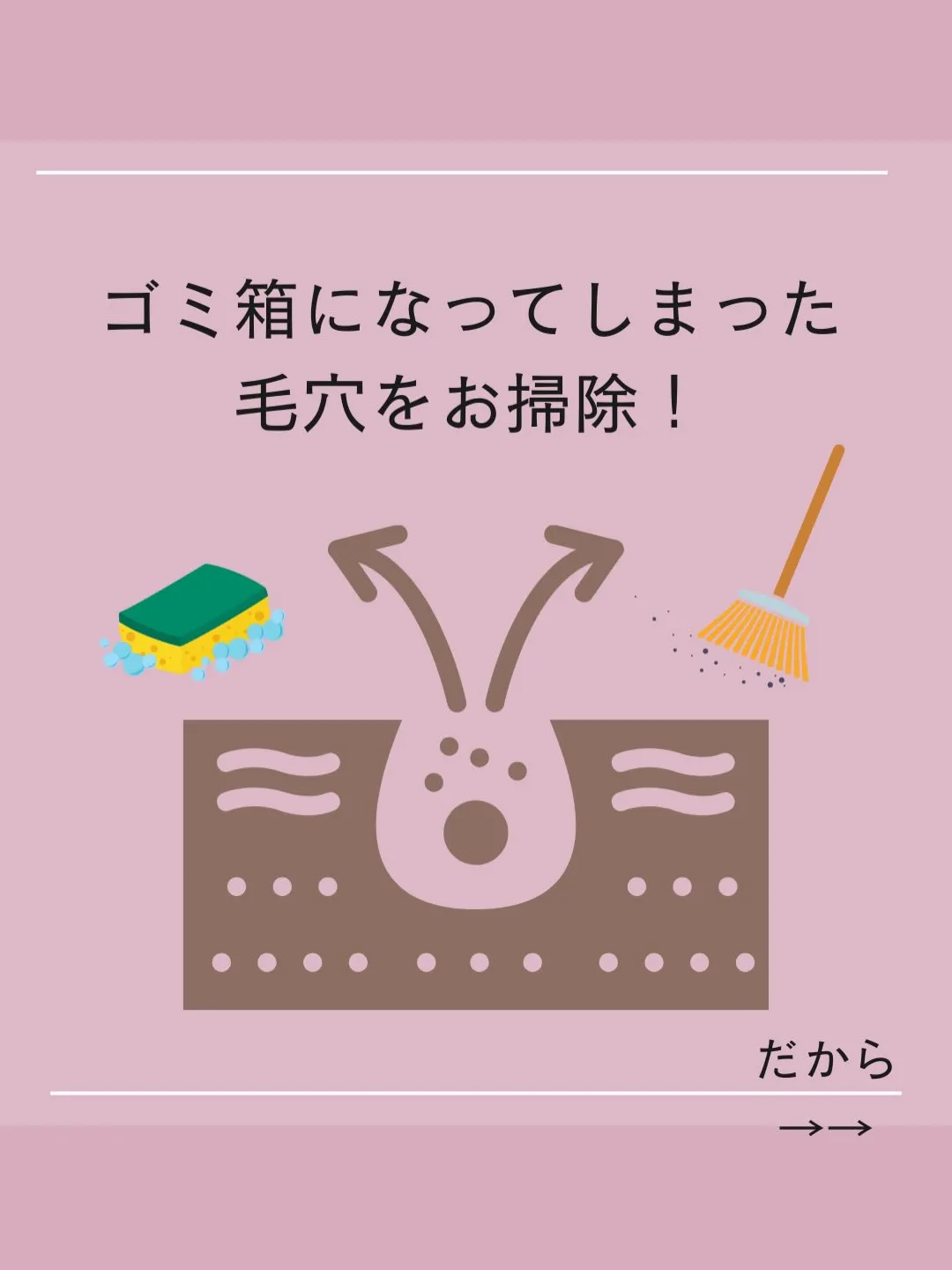 ニキビ肌卒業への近道