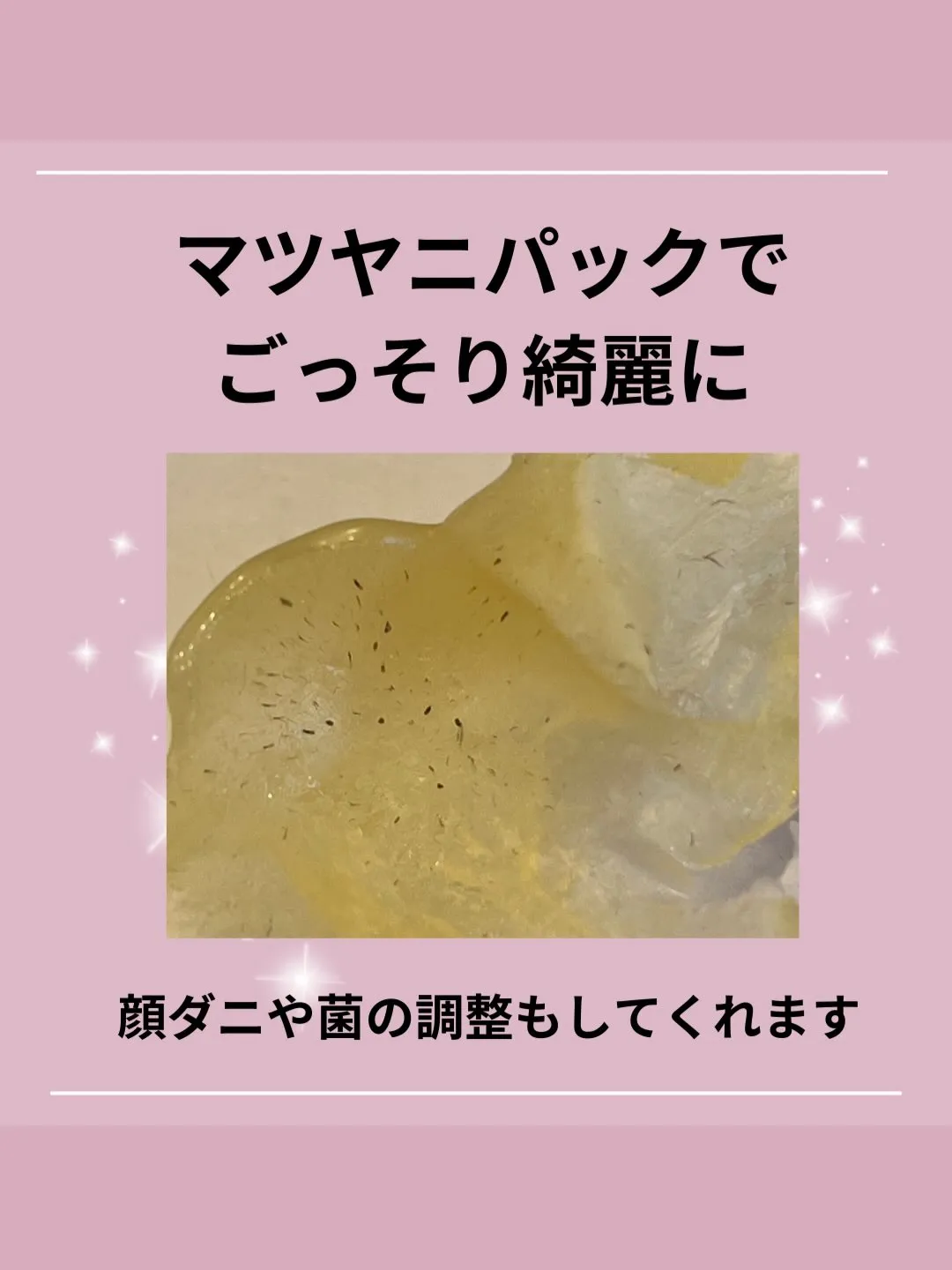 ニキビ肌卒業への近道