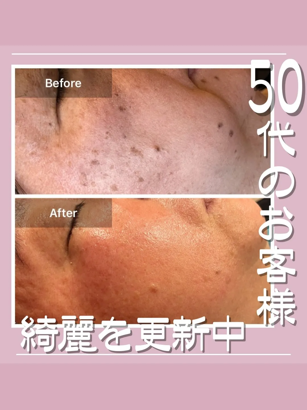 <鎌倉>50代のお客様、綺麗を更新中🤩