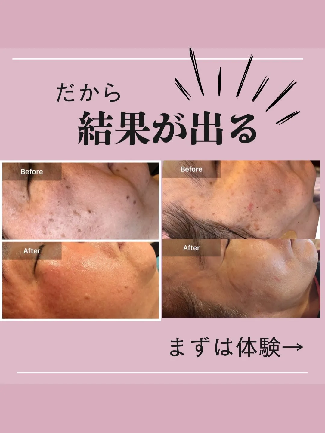 50代のお客様、綺麗を更新中🤩