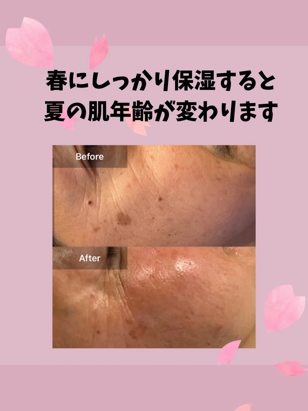 急激に増える春の隠れ乾燥