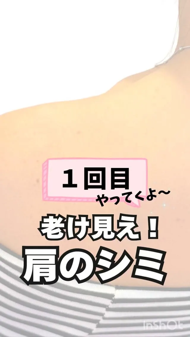 <鎌倉>「顔は完璧！...でも、その肩。