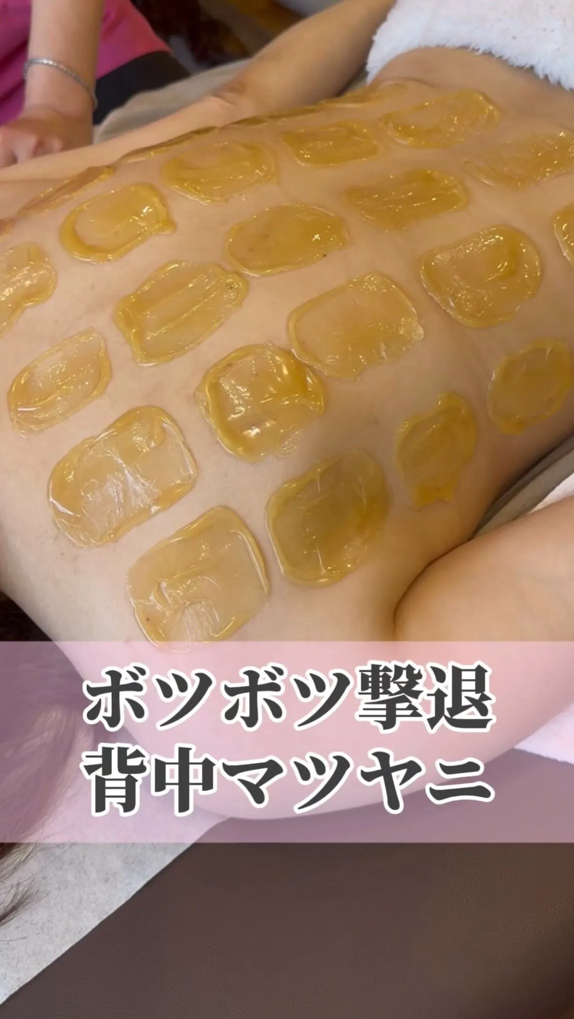 夏前こそ、背中ケアは超大事！！