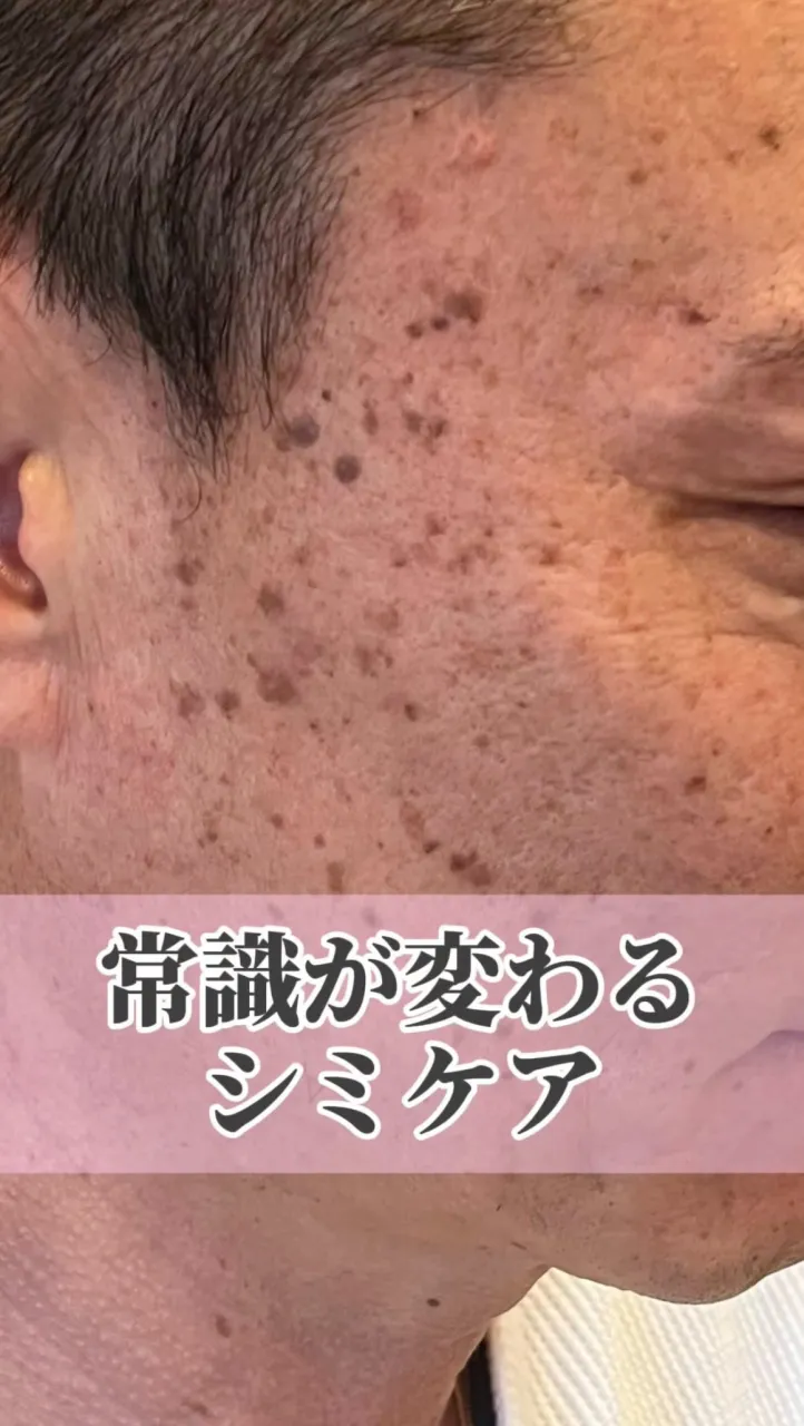 〈実は人気No.1シミケア〉